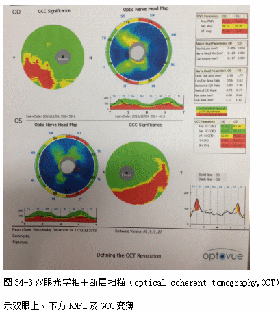 ZY016_175_4.gif